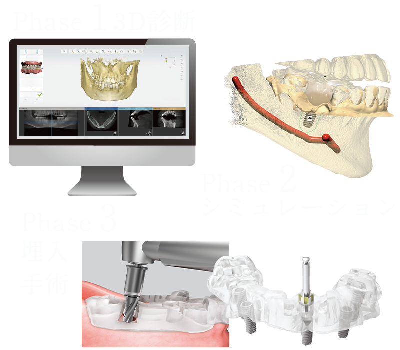 オステムワンガイド